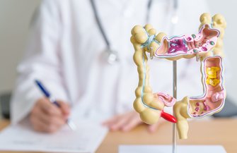 Colorectal Cancer Study