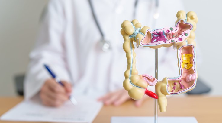 Colorectal Cancer Study