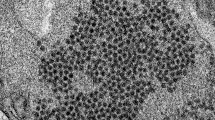 01142019_enterovirus_d68_CDC