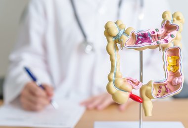 Colorectal Cancer Deaths