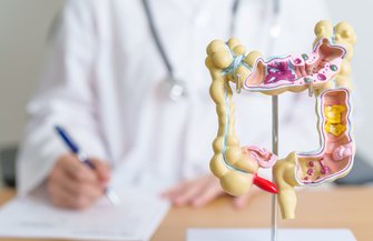 Colorectal Cancer Deaths