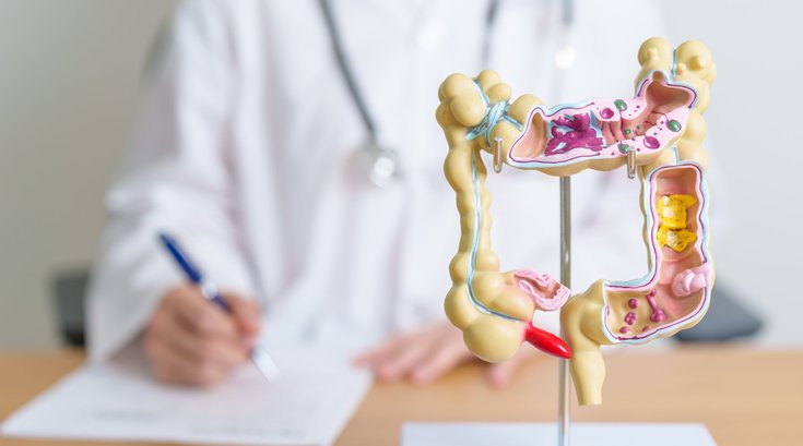 Colorectal Cancer Deaths