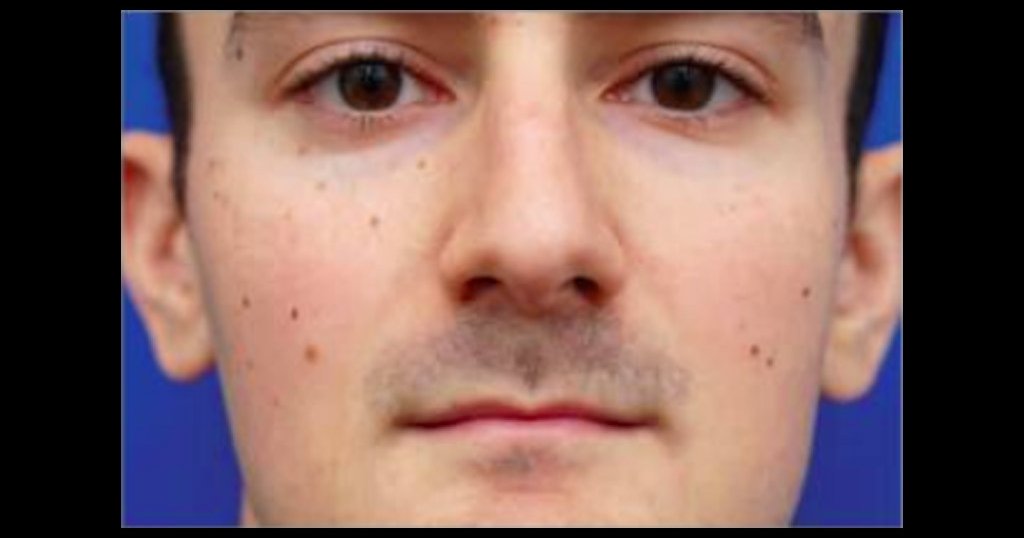 Why Does My Nose Look Bigger On Camera www.phillyvoice.com