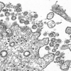 Coronavirus Montgomery County