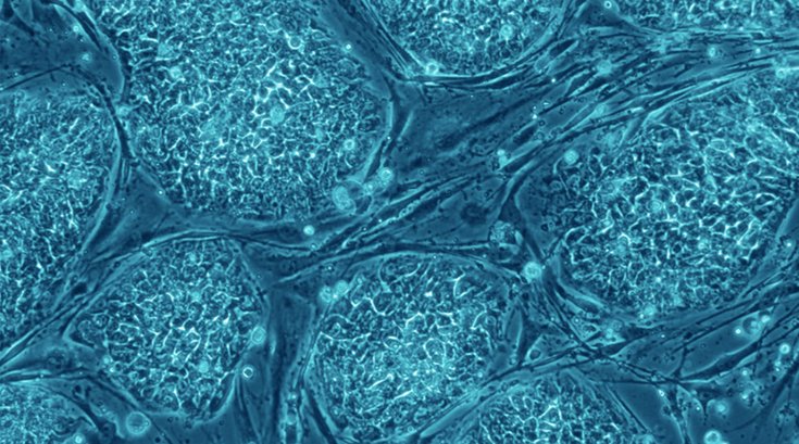 03262018_human_stem_cells_wiki