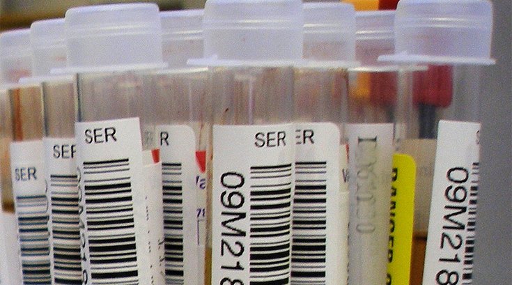 03292018_blood_test_vials_wiki