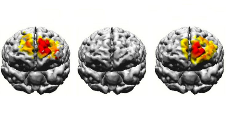 Brain Electrostimulation Boston University 04092019