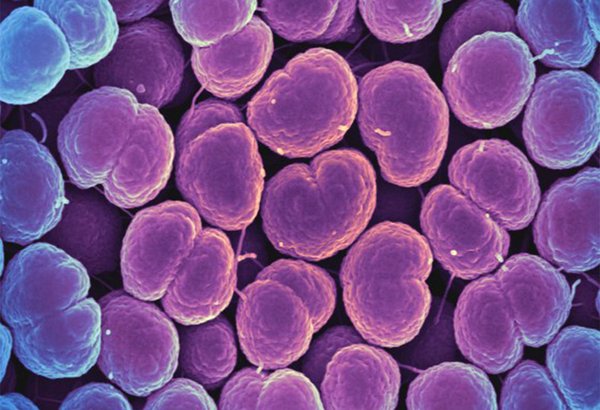 Gonorrhea bacteria NAIAD 04192019