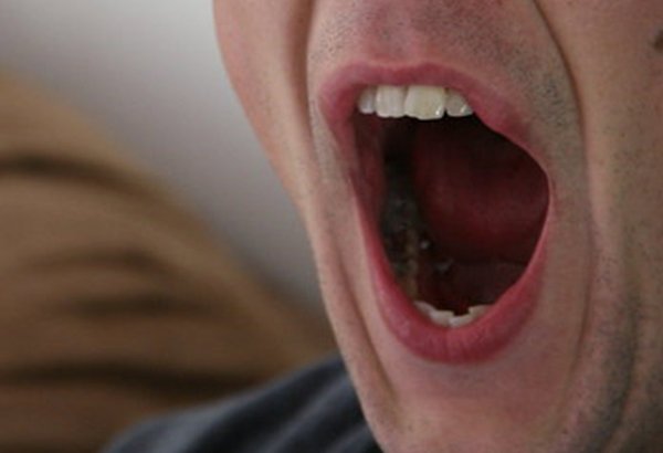 Man Yawn 04302019