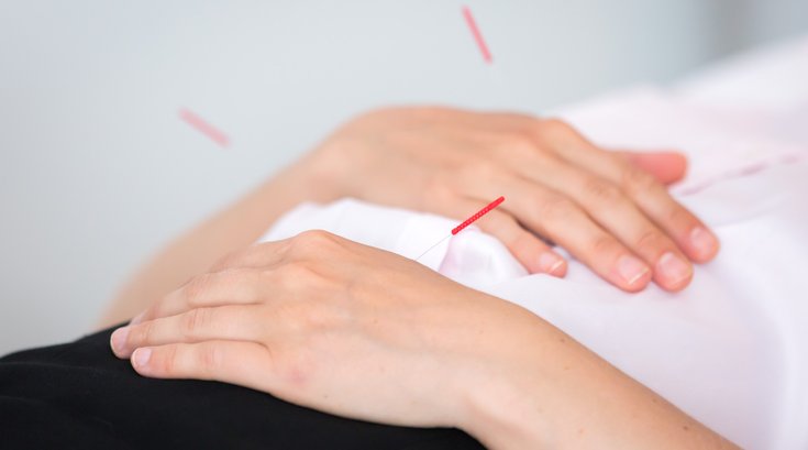 Carroll - Acupuncture