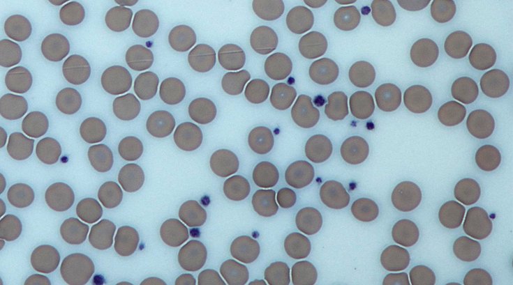 Platelets Blood Red White Cells 05062019