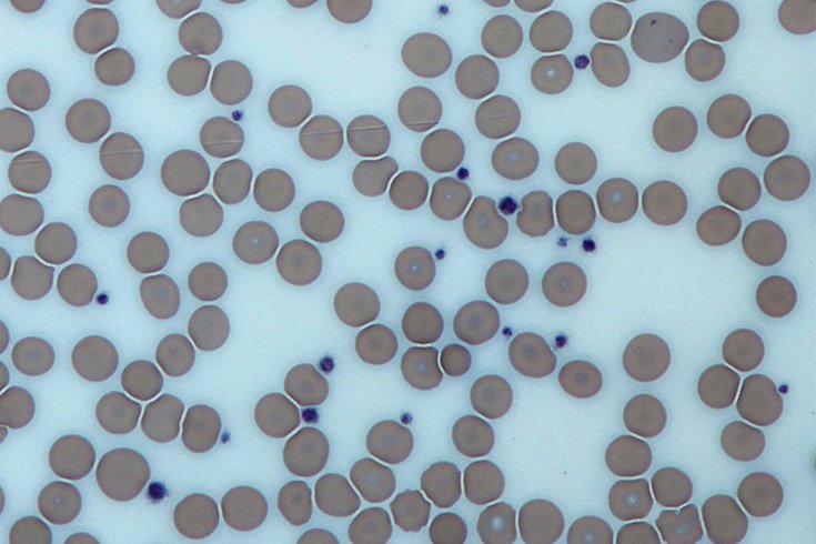 Platelets Blood Red White Cells 05062019