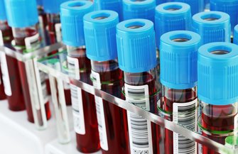 Alzheimer's Blood Test
