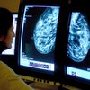 Dense Breasts Cancer Screening
