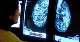 Dense Breasts Cancer Screening