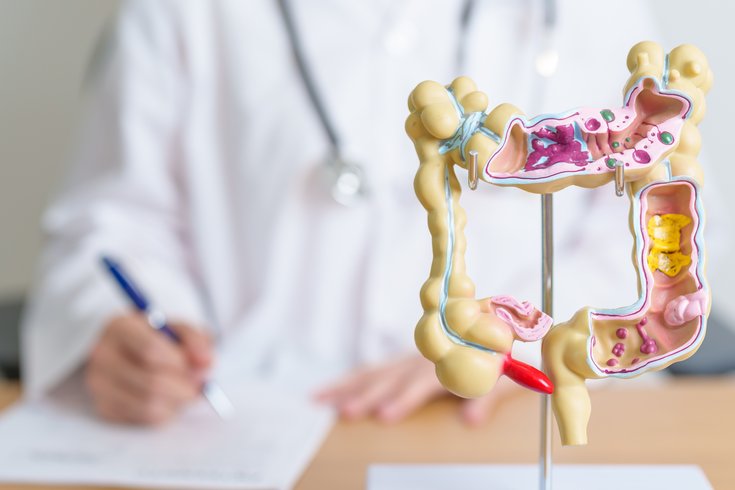Colorectal Cancer Toxin