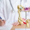 colorectal cancer screening