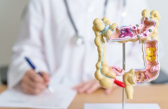 colorectal cancer screening