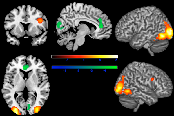 implicit bias disfigured faces