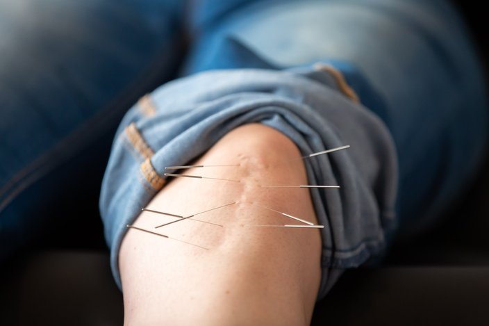 Carroll - We Tried It - Summit Acupuncture