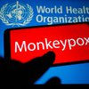 Monkeypox Philadelphia