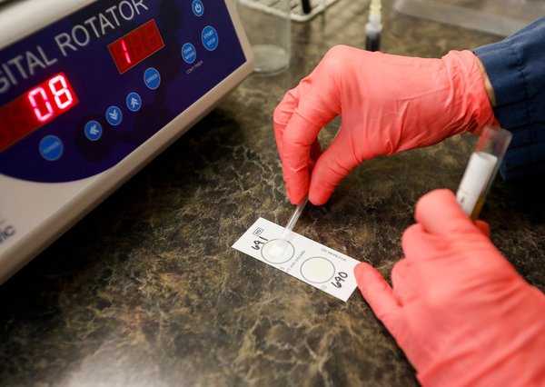 CDC doxy Pep syphilis