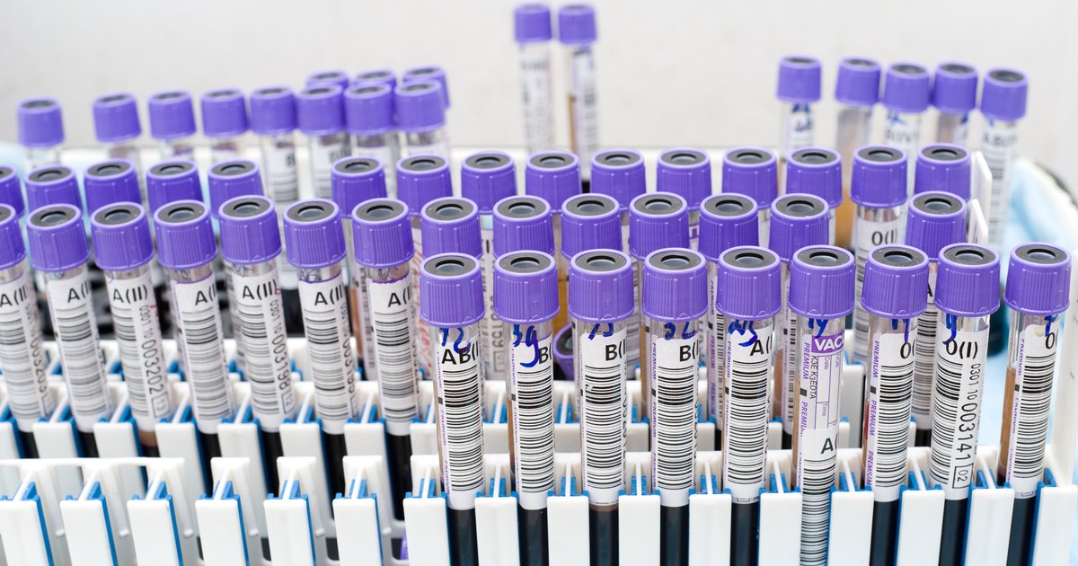 Пробирка с пивом. Вода в пробирке. Анализы пробирки. Пробирки с донорской. Стеклянные трубки для хим лабораторий.