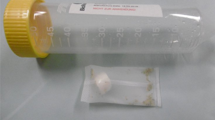 061626MedicalMaggotsWounds.jpg
