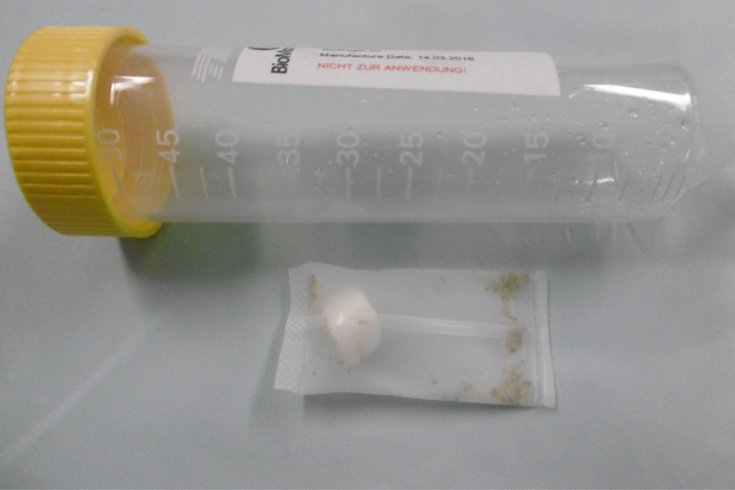 061626MedicalMaggotsWounds.jpg