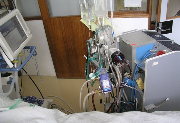 ECMO Treatment Flu Patient 06182019