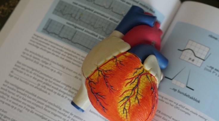Heart Attack Deaths