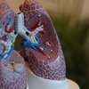 New lung cancer screening guidelines