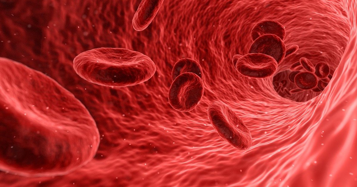 Anemia may be a risk factor for post-COVID syndrome, new study shows - Vimarsana News