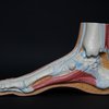 Achilles tendon pain