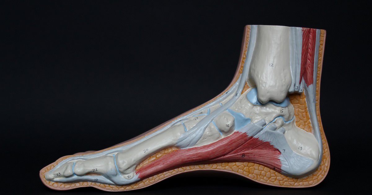 Custom Orthotics For Achilles Tendonitis | lupon.gov.ph