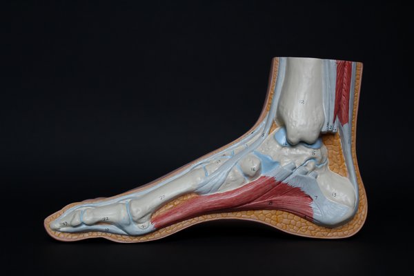 Burning sensation store in achilles tendon