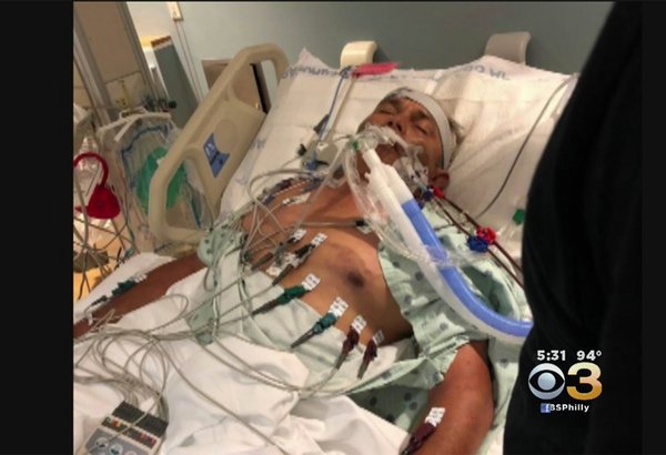 07202018_angel_perez_CBS3