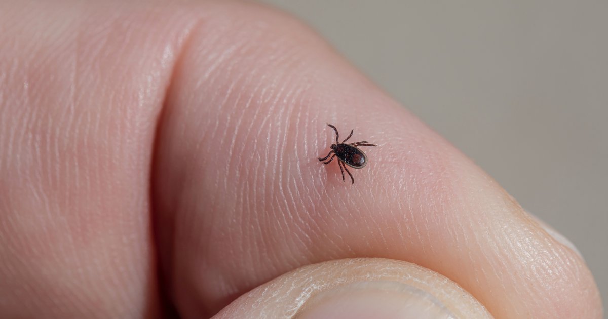 Alpha Gal Syndrome A Meat Allergy Caused By Lone Star Ticks Is Becoming More Common Cdc