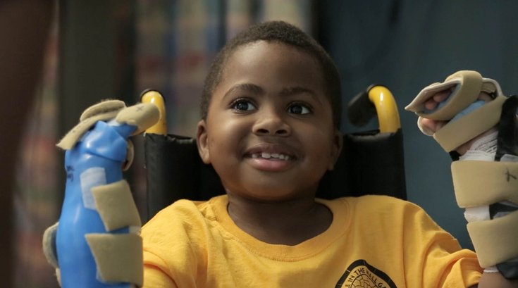 07282015_zion_hand_transplant_CHOP