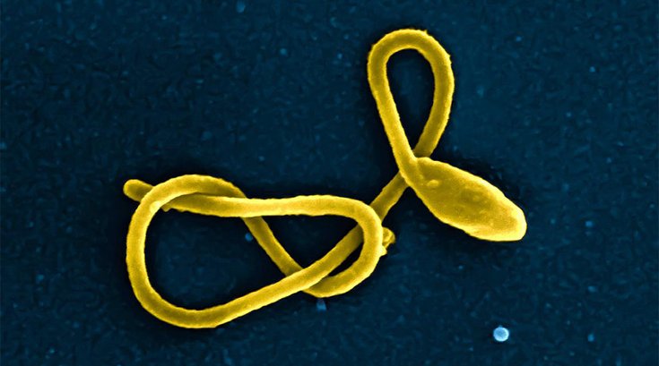 07302018_ebola_virus_wiki