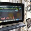 EKG Heart Failure