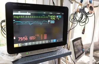EKG Heart Failure