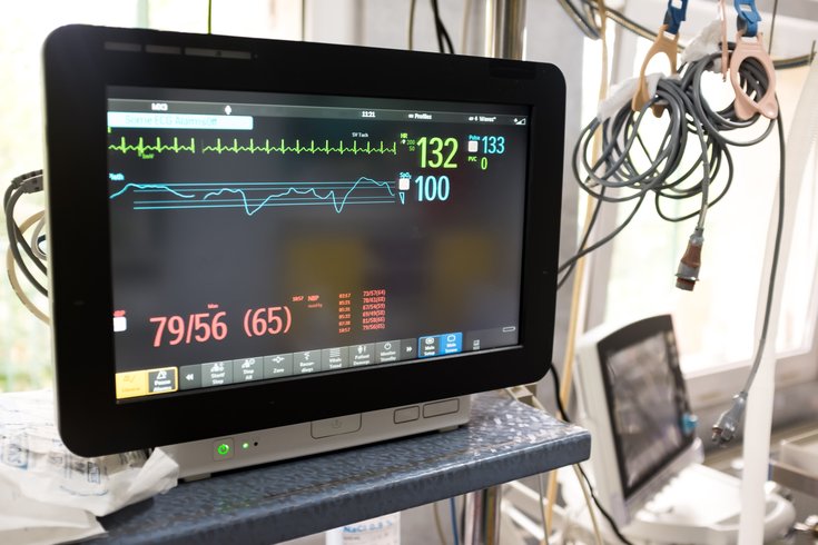 EKG Heart Failure