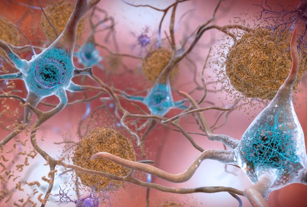 Tau Protein Brain 08092019