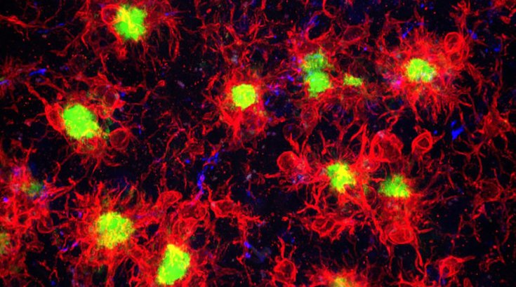 Plaques Microglia University California 08212019
