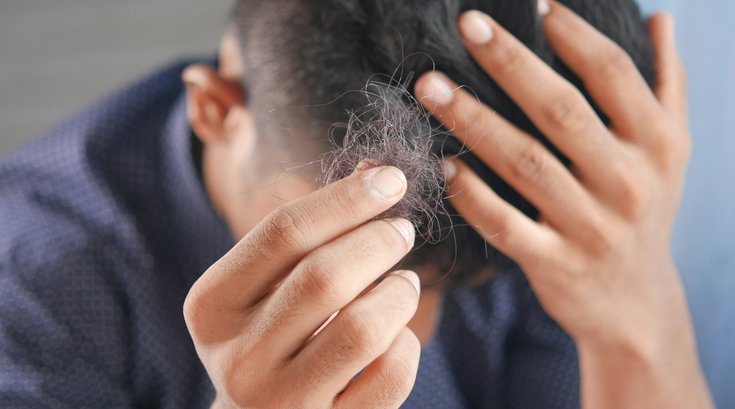 Hair Loss GLP-1s