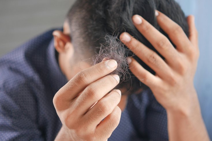 Hair Loss GLP-1s