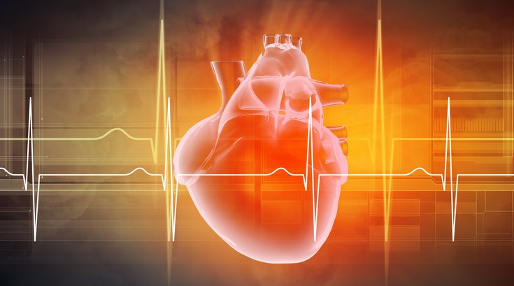 MIS-C Myocarditis Children