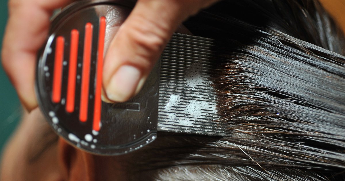 New head lice guidelines Children can remain in school while receiving