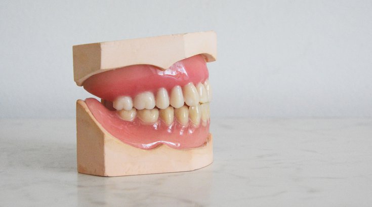 Teeth tiktok